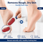 2-in-1 Dual-Sided Foot Callus Remover – Replaceable Stainless Steel Scraper
