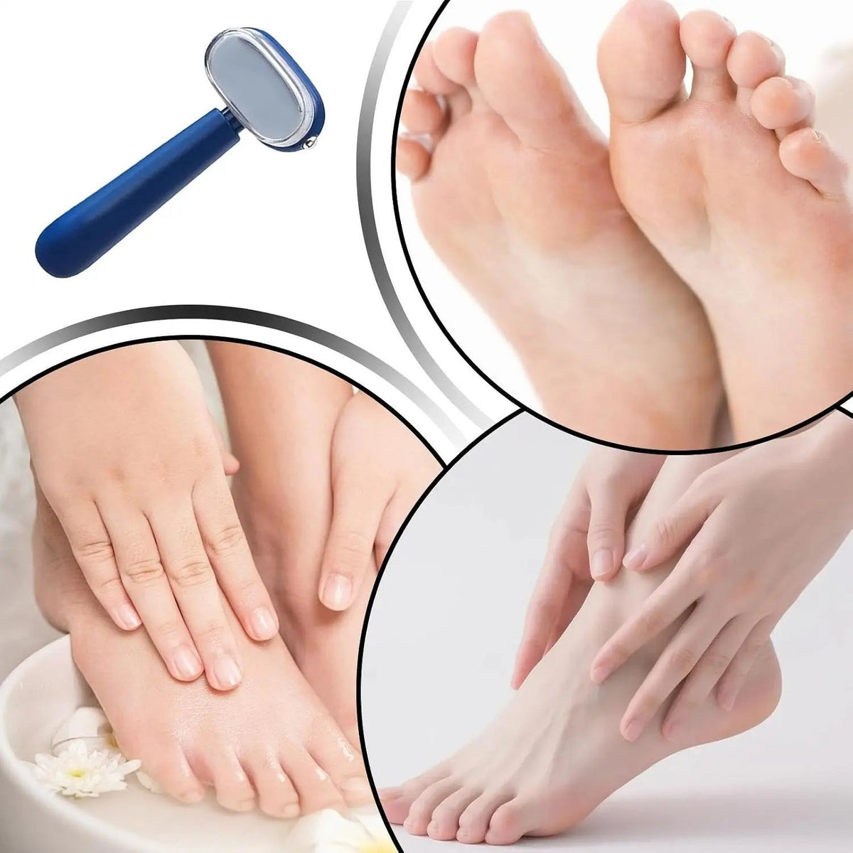Dual‑Sided Foot Callus Remover