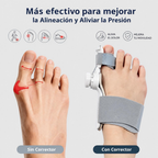 Corrector de Juanete Ajustable - 对比/缓解压力