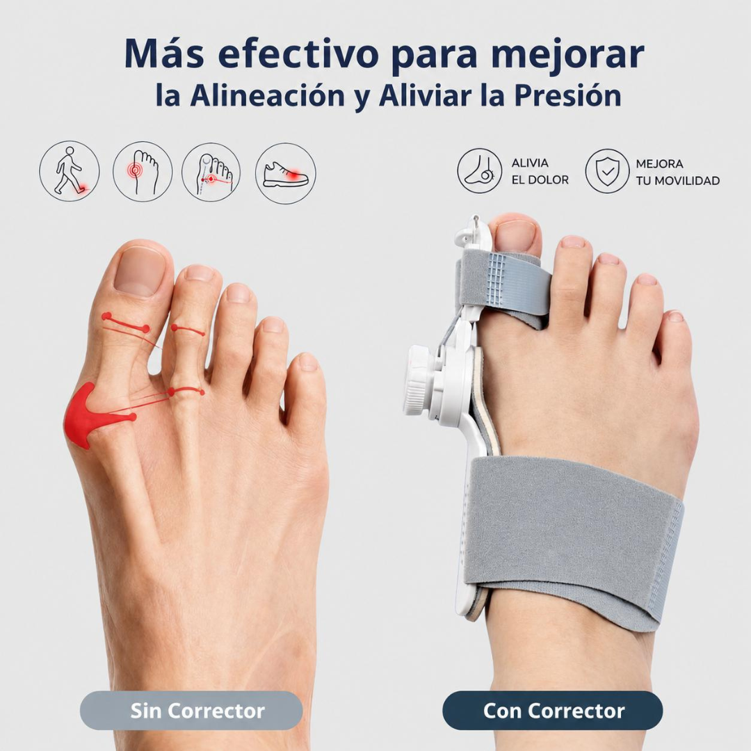 Corrector de Juanete Ajustable - 对比/缓解压力